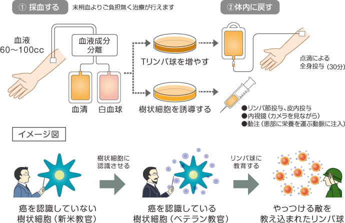 DC療法の流れ