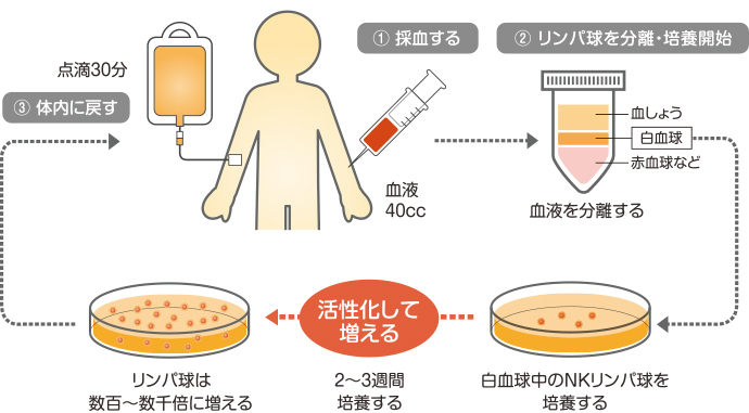 NK療法の流れ